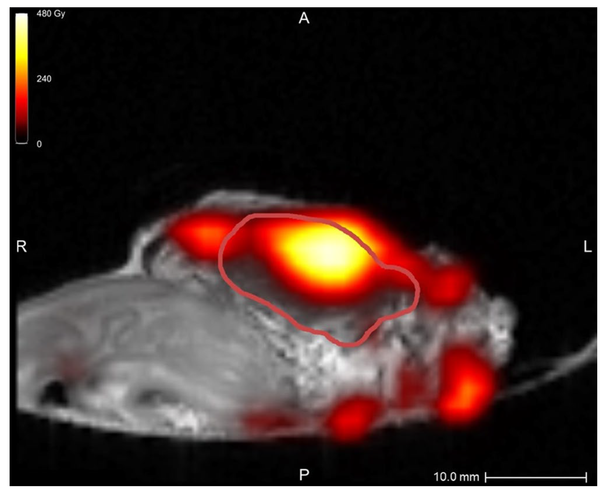 Cancers 17 01028 g004