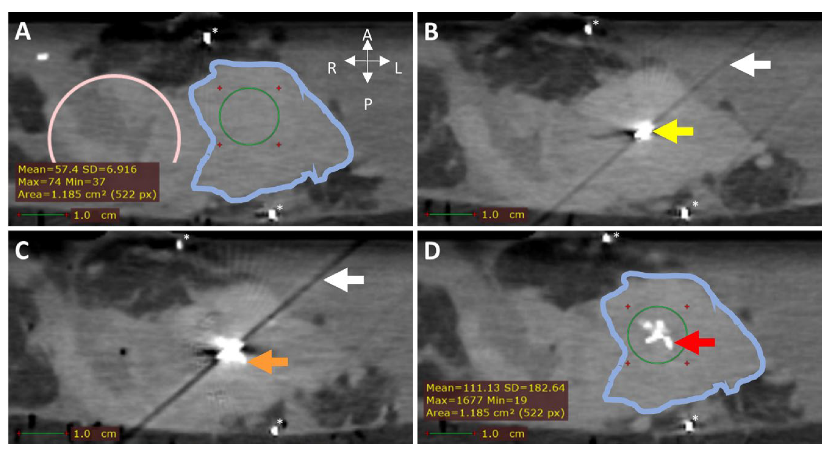 Cancers 17 01028 g006