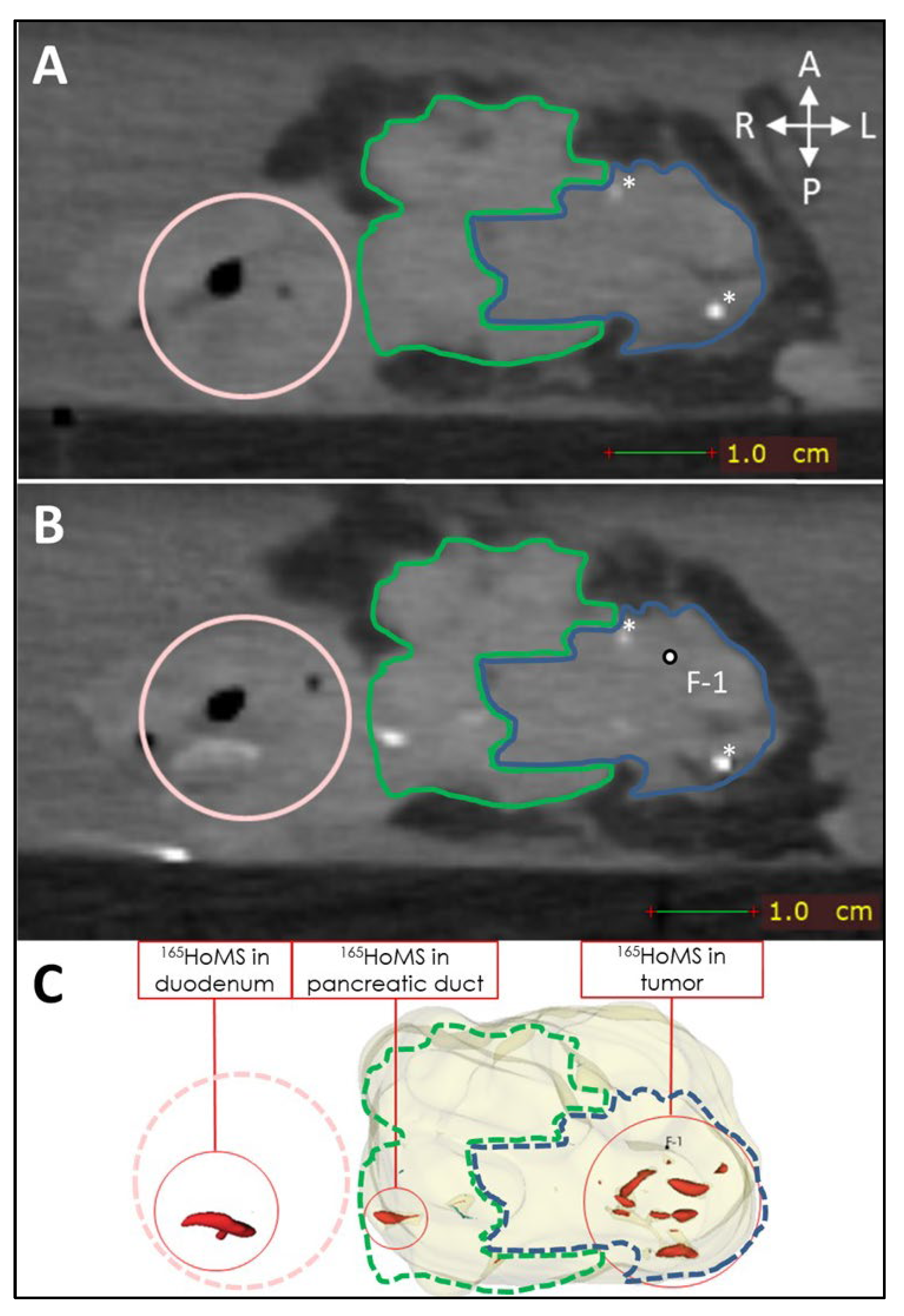 Cancers 17 01028 g007