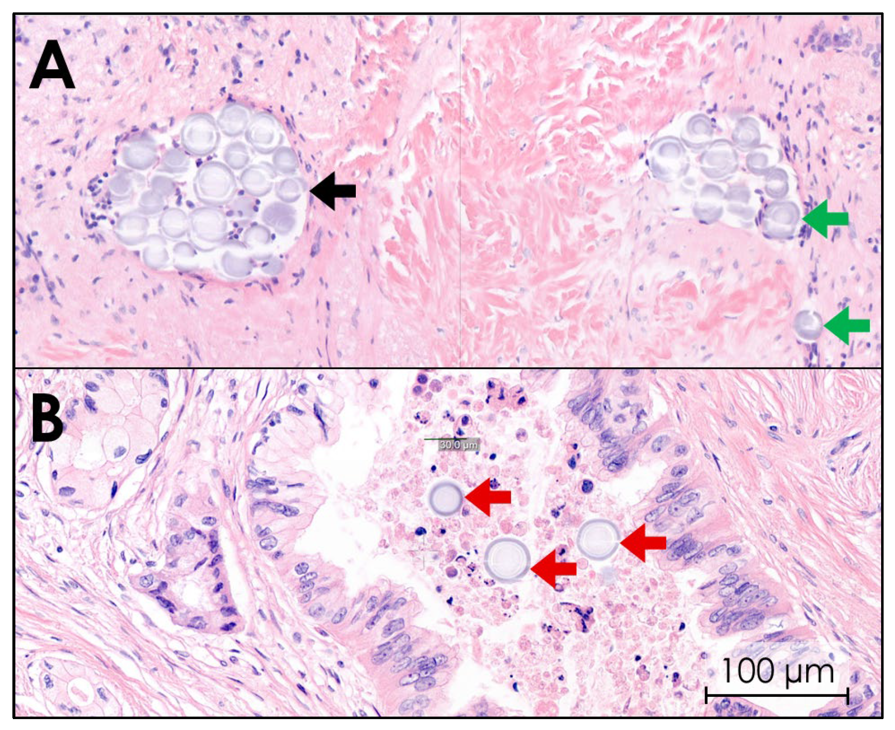 Cancers 17 01028 g008