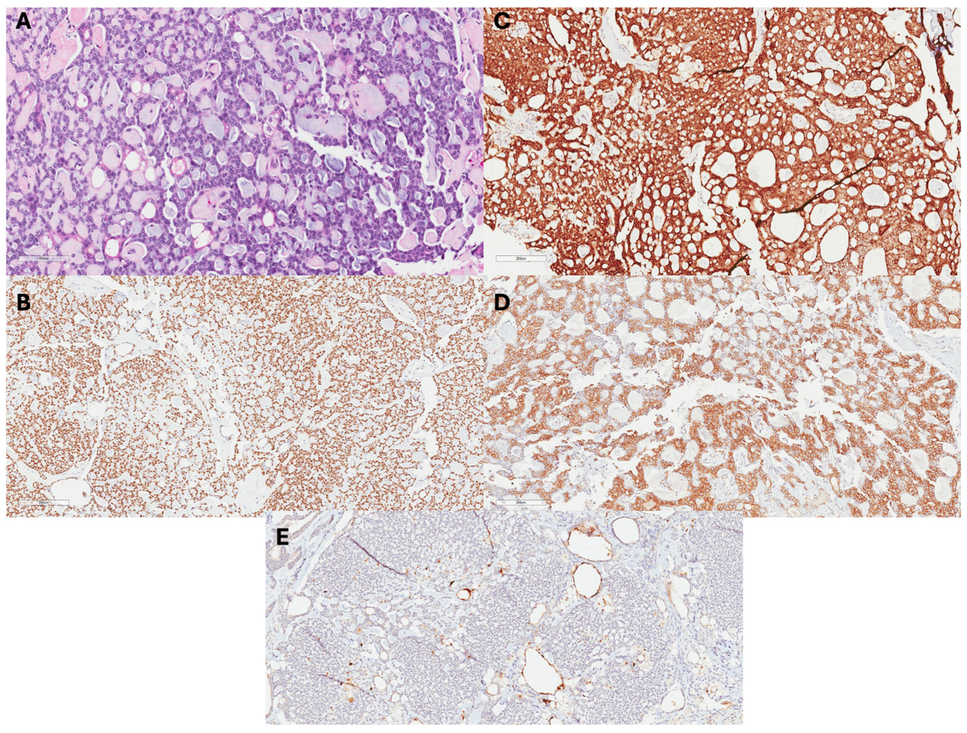 Cancers 17 01079 g001