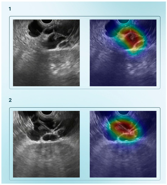 Cancers 17 01132 g001