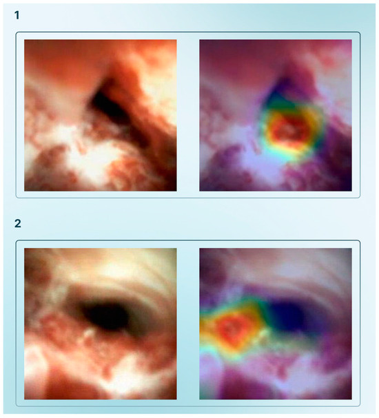 Cancers 17 01132 g002