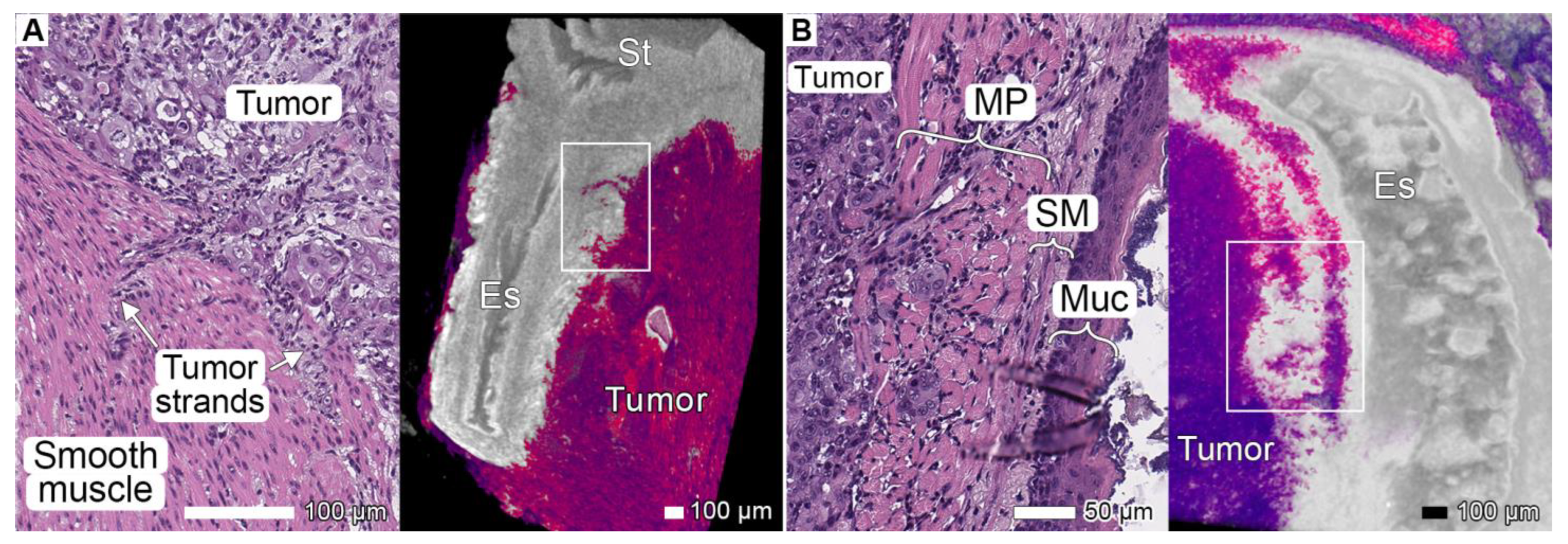 Cancers 17 01139 g001