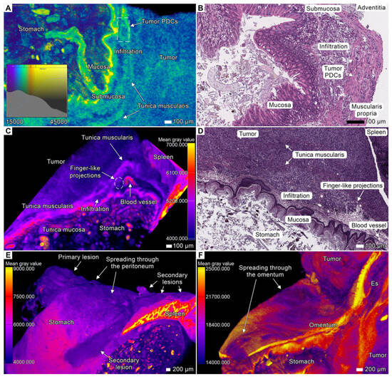 Cancers 17 01139 g002