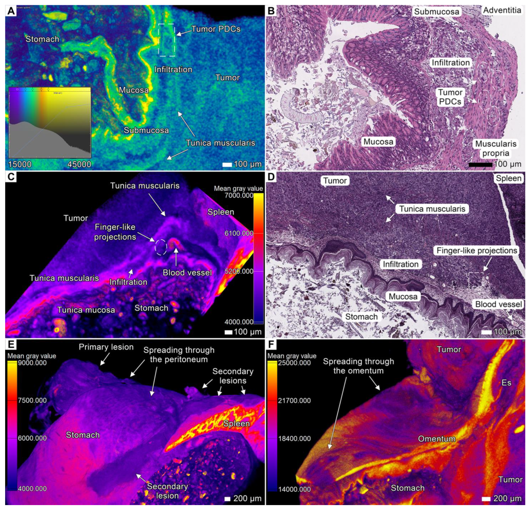 Cancers 17 01139 g002