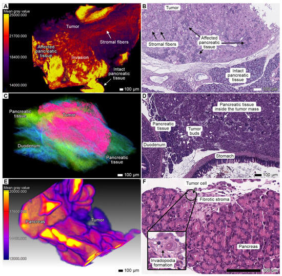Cancers 17 01139 g004