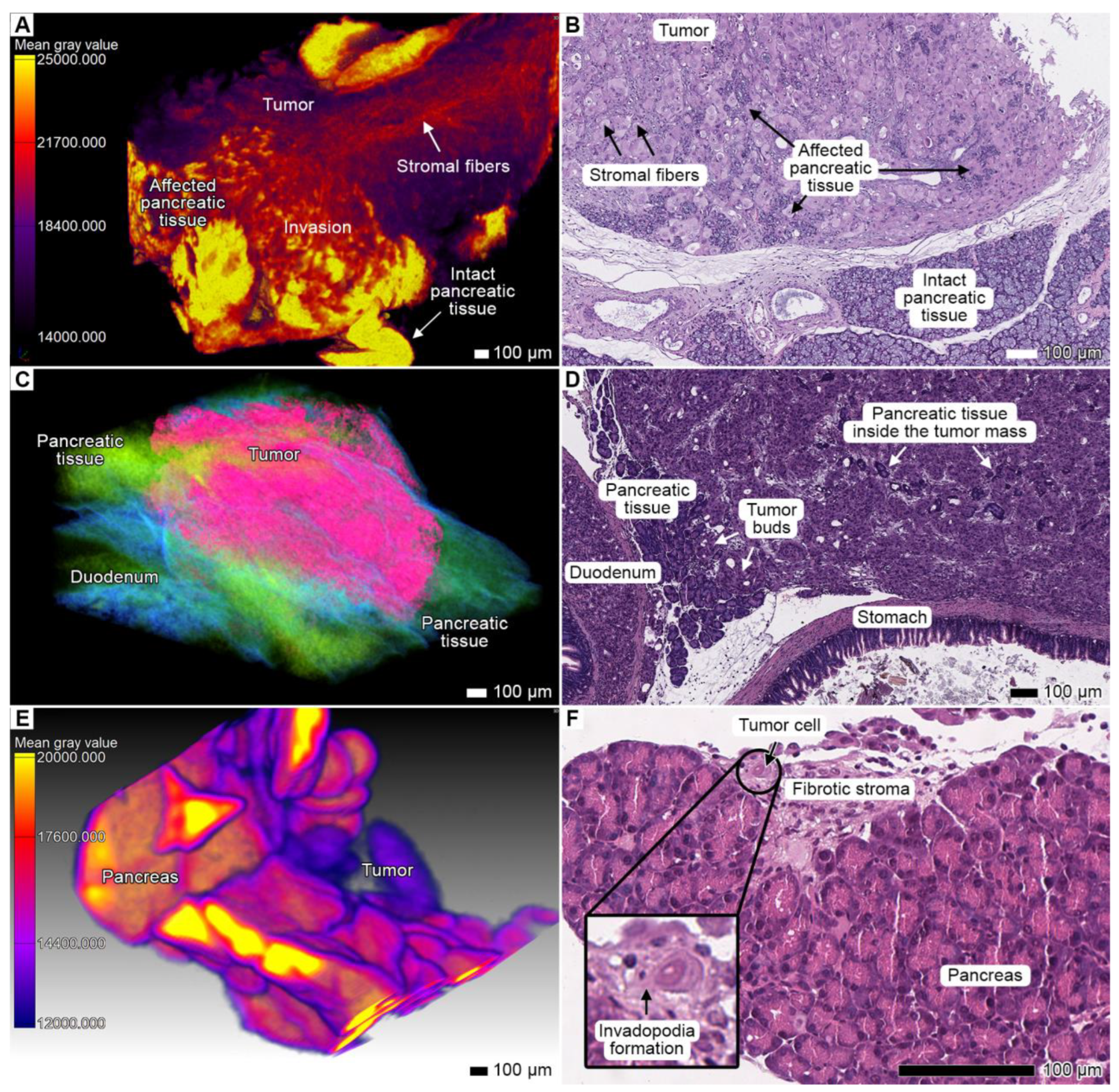 Cancers 17 01139 g004