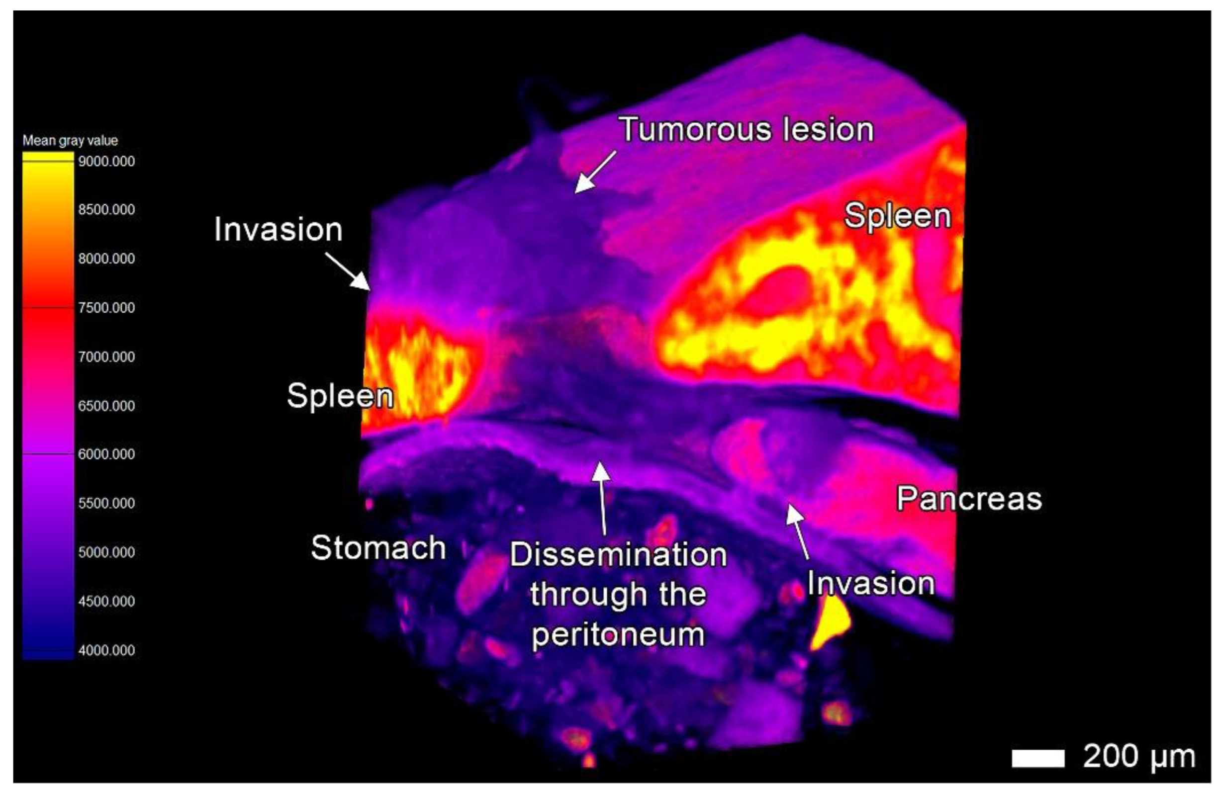 Cancers 17 01139 g005