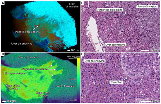 Cancers 17 01139 g006