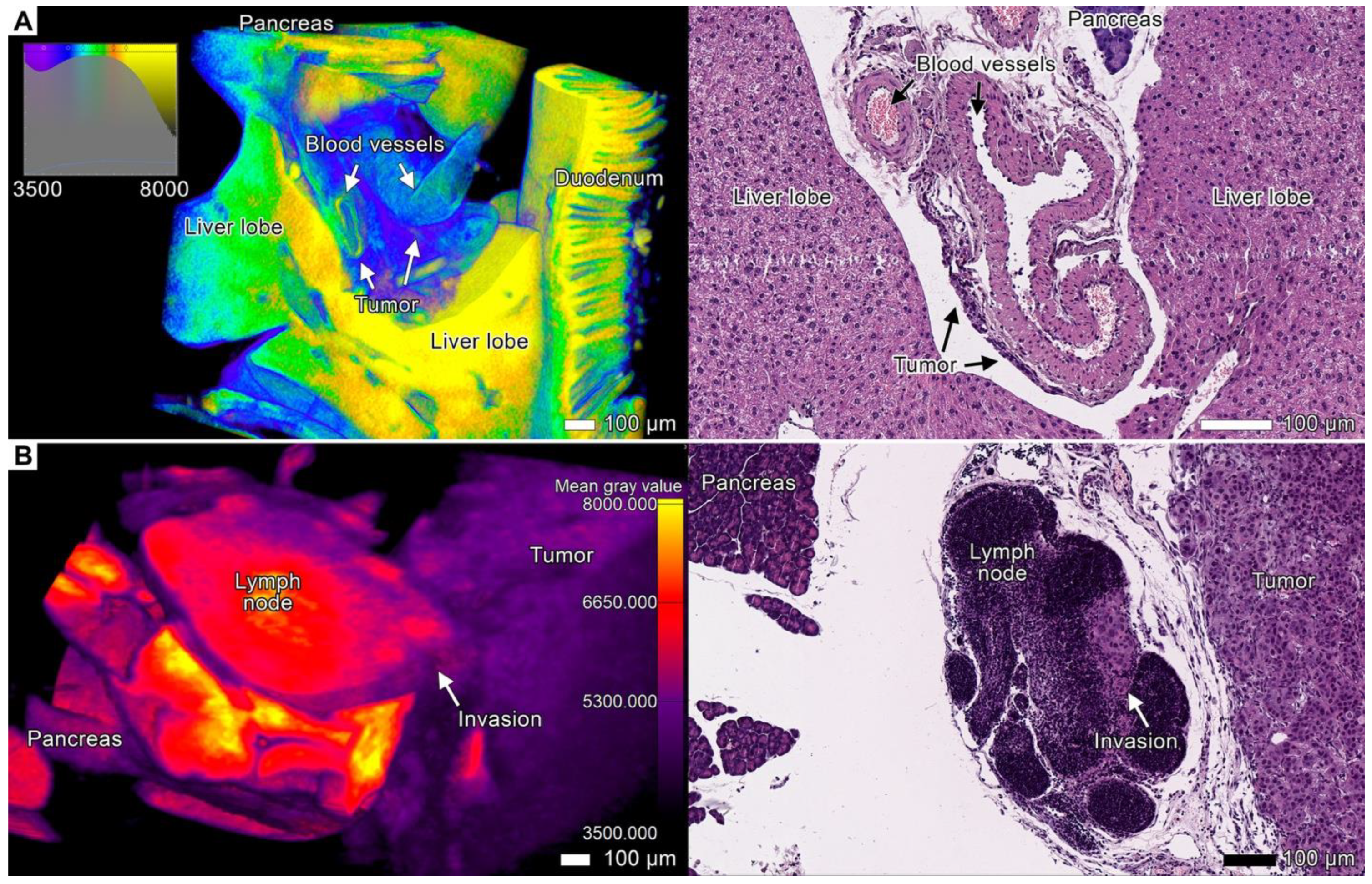 Cancers 17 01139 g009