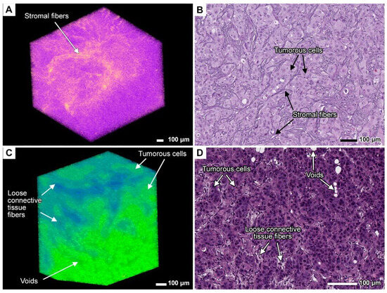 Cancers 17 01139 g010