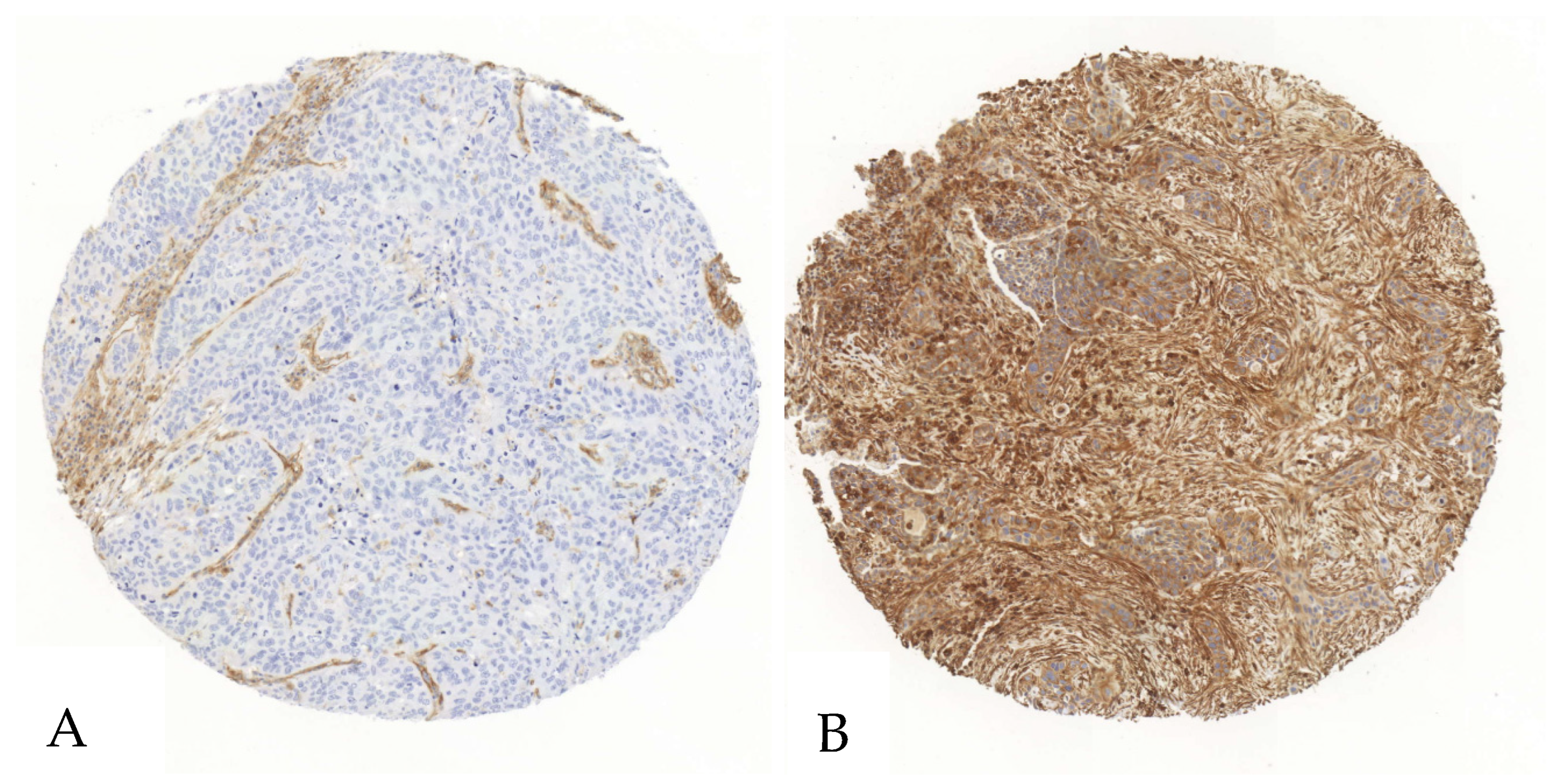 Cancers 17 01142 g001