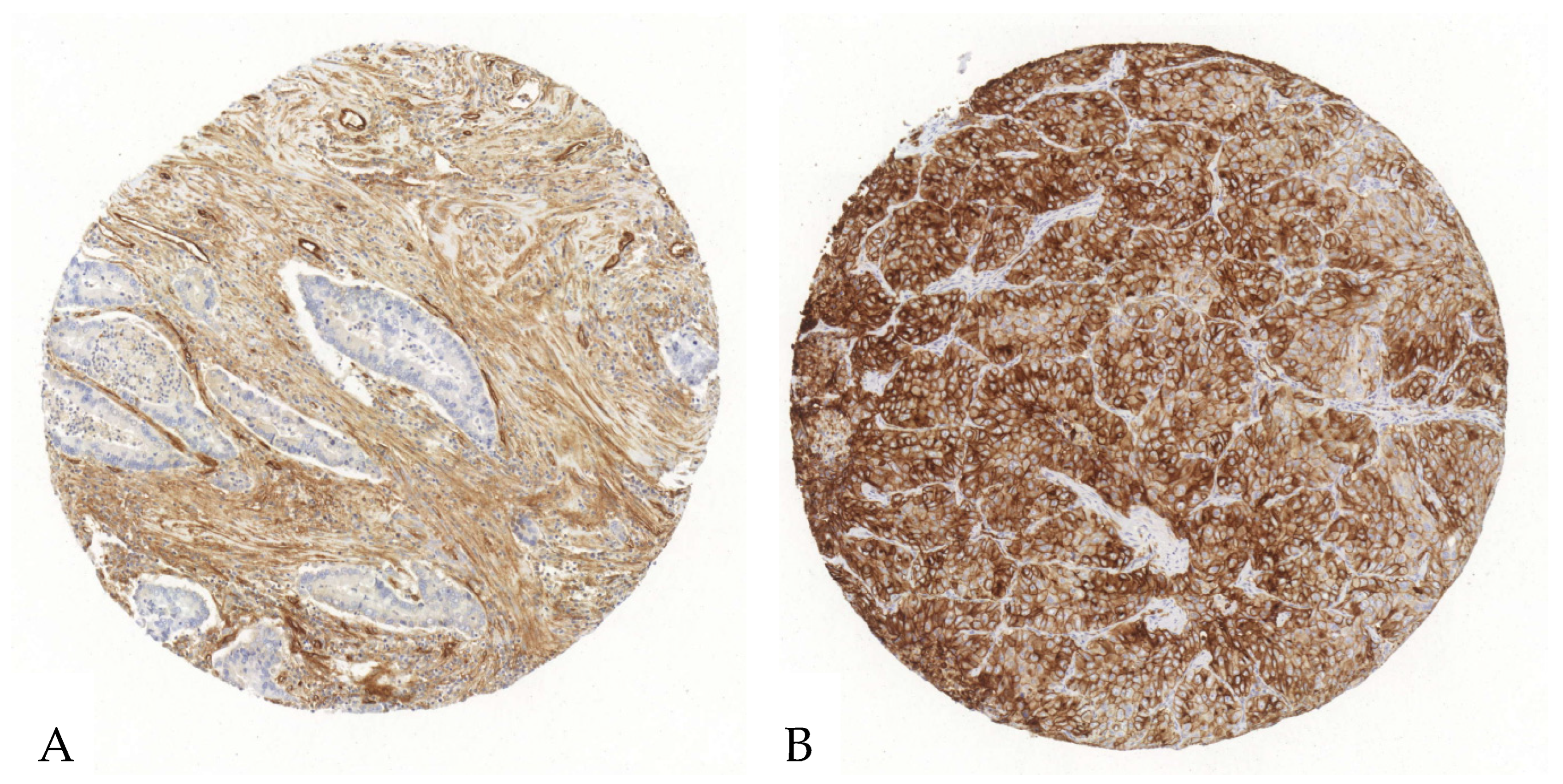 Cancers 17 01142 g002