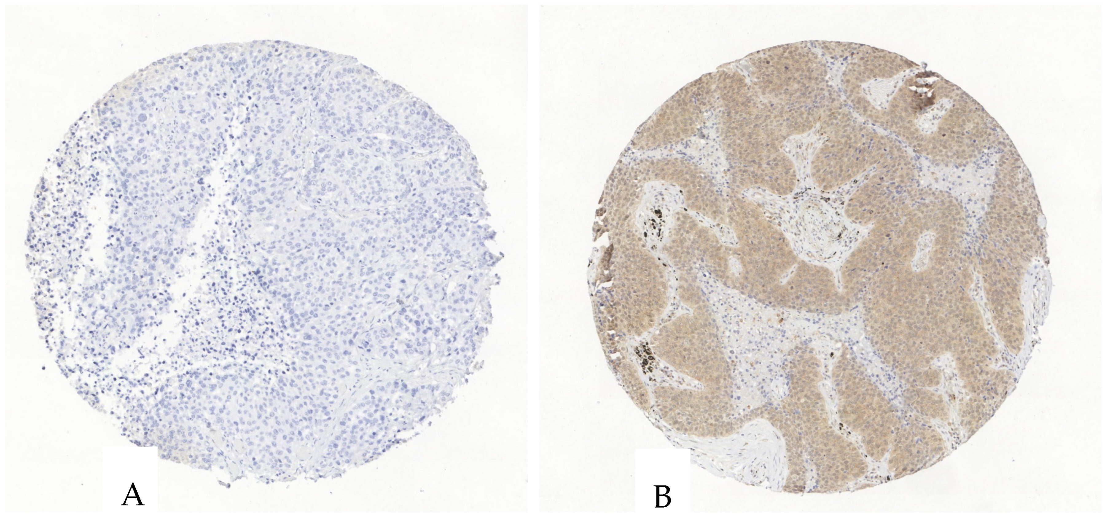Cancers 17 01142 g004