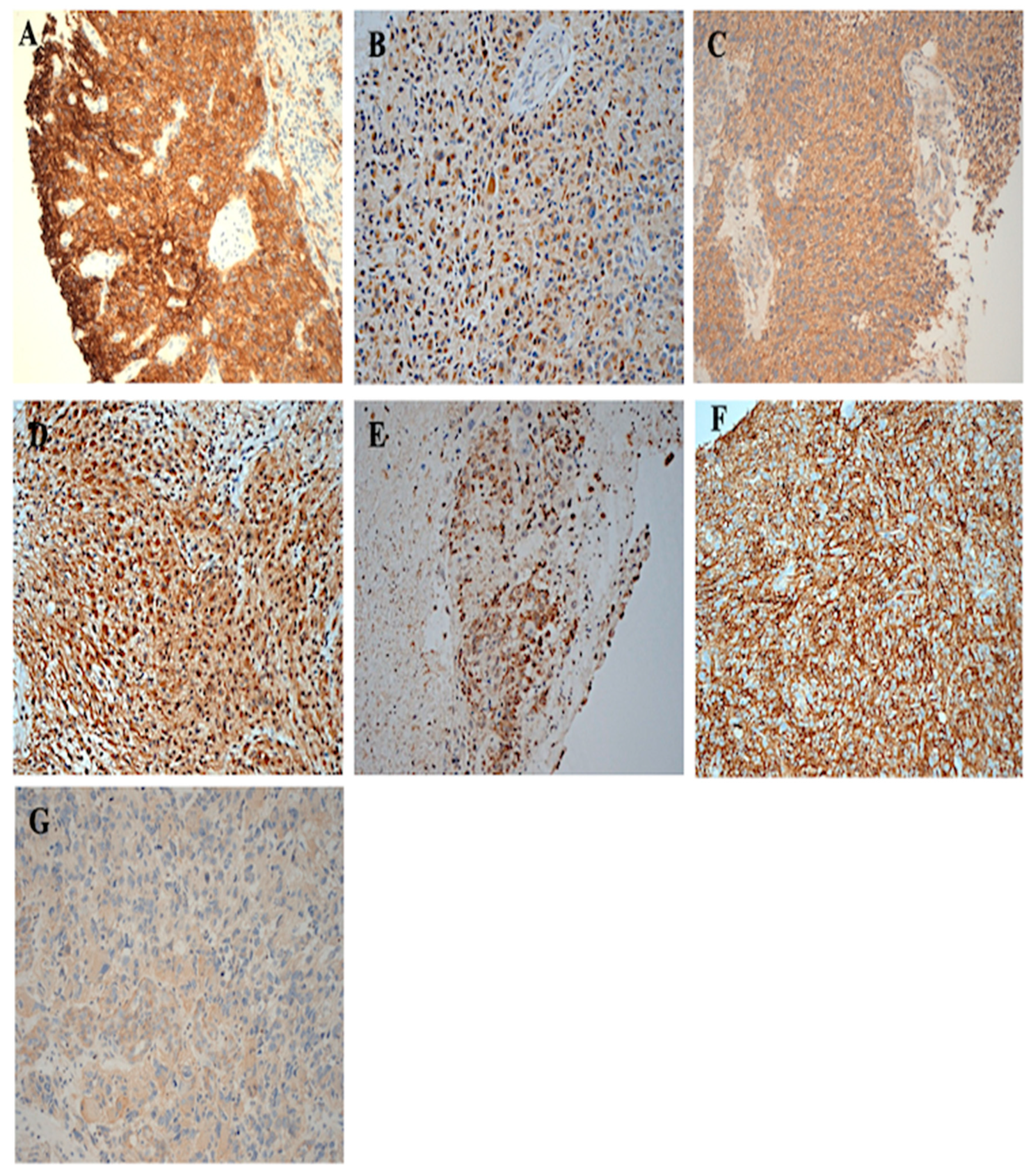 Cancers 17 01221 g001 Cancers 17 01221 g001