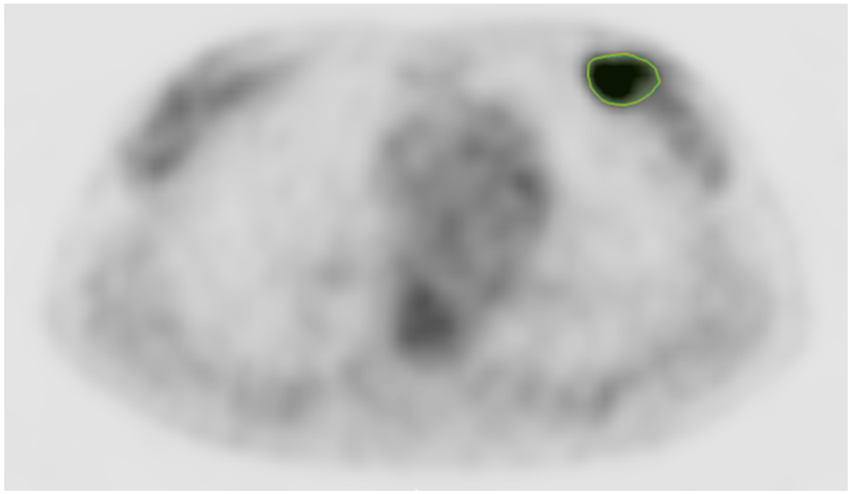 Cancers 17 01249 g001 Cancers 17 01249 g001