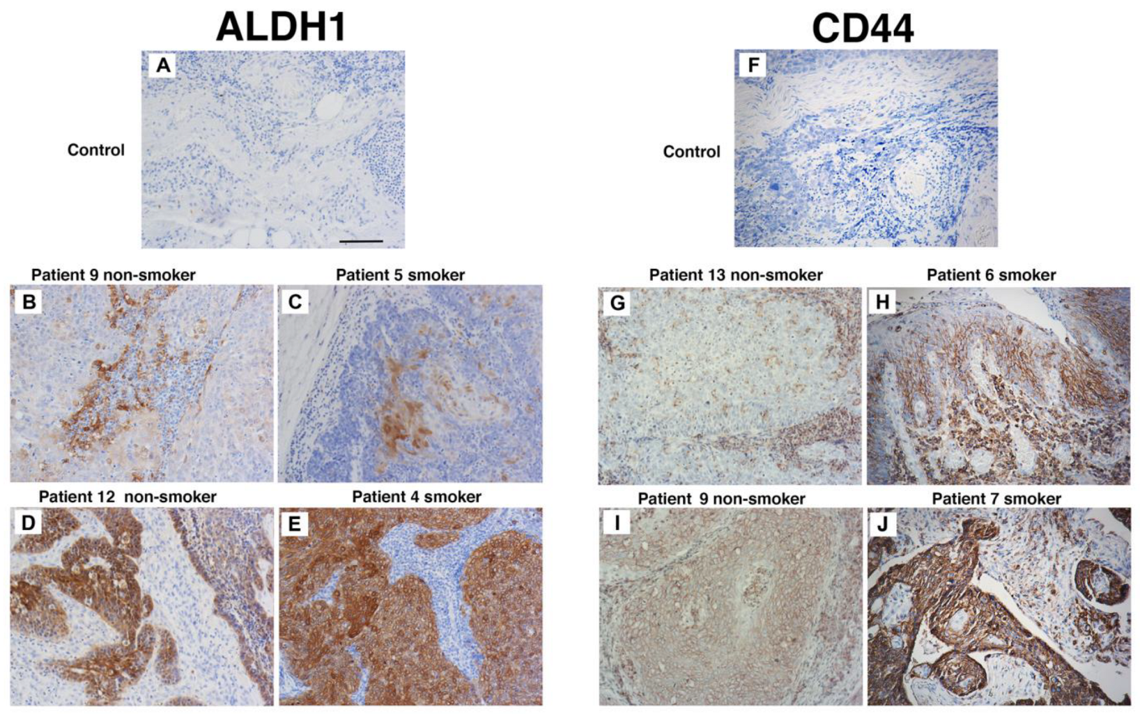 Cancers 17 01346 g004