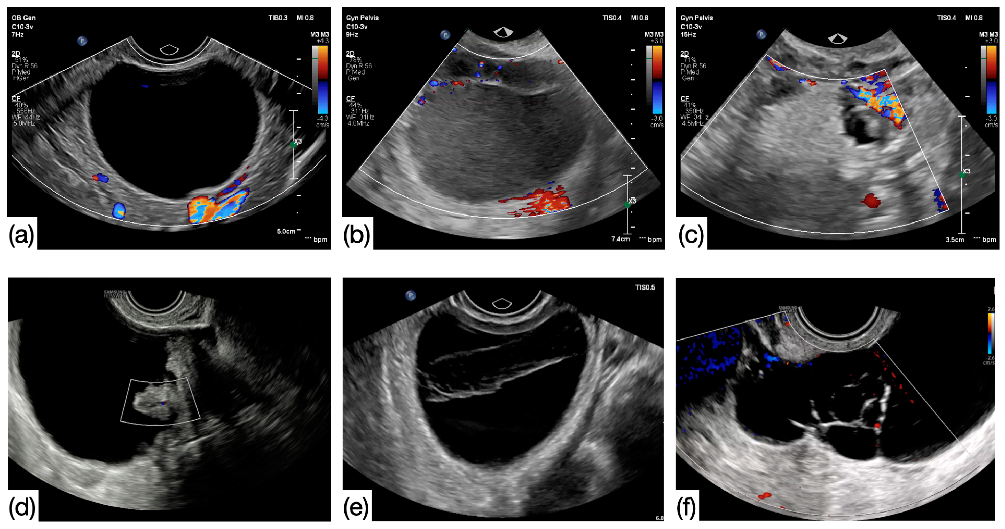 Cancers 17 01370 g001 Cancers 17 01370 g001