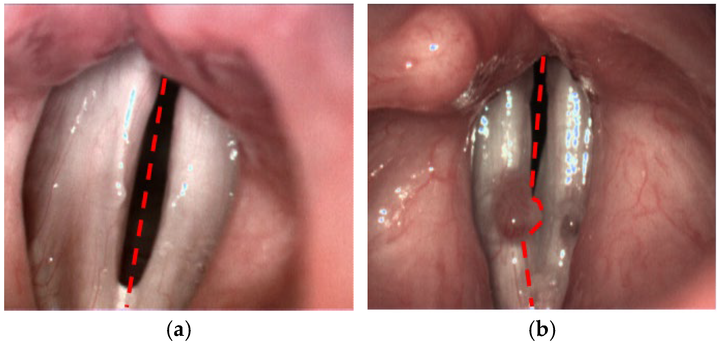 Cancers 17 01376 g001