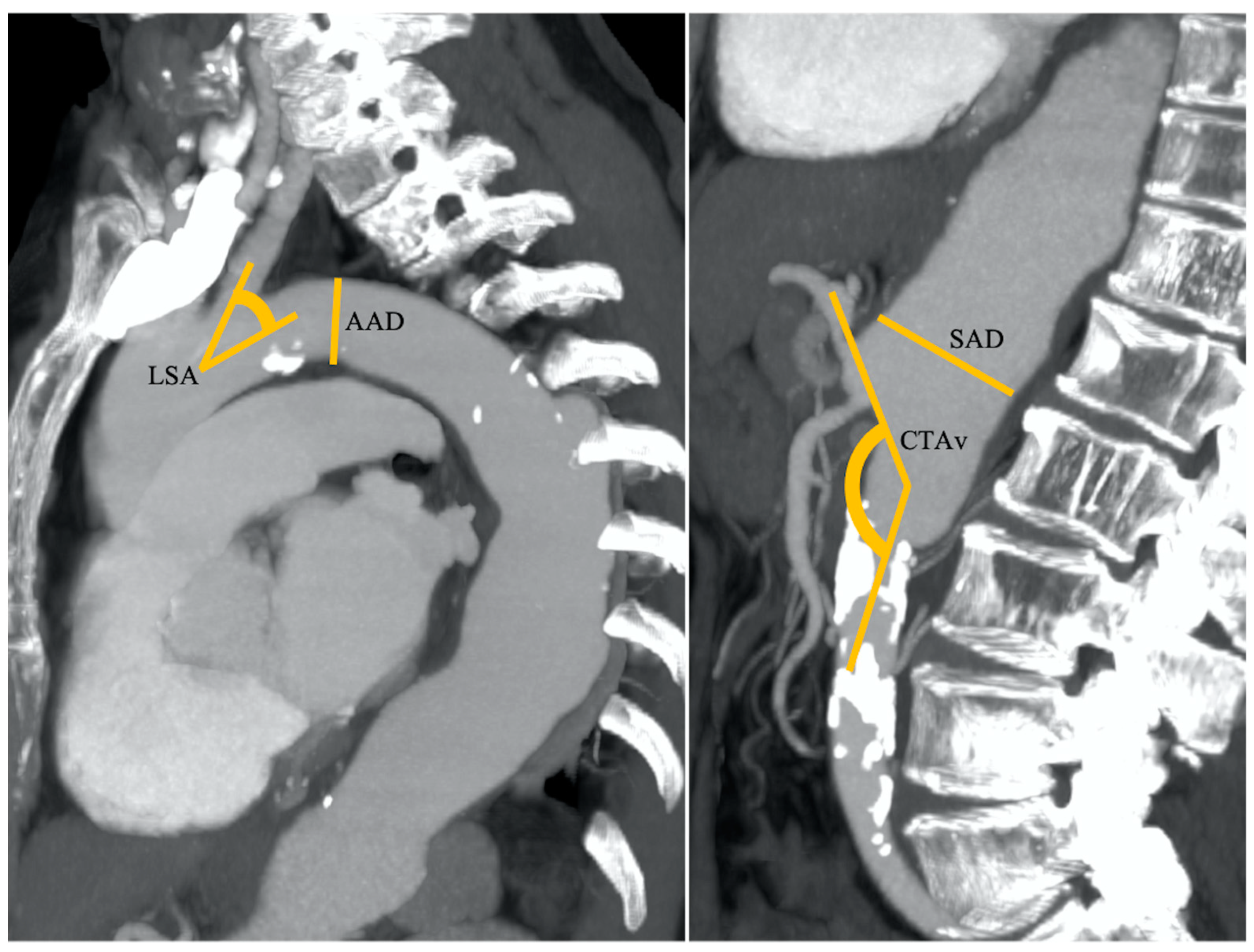 Cancers 17 01385 g002