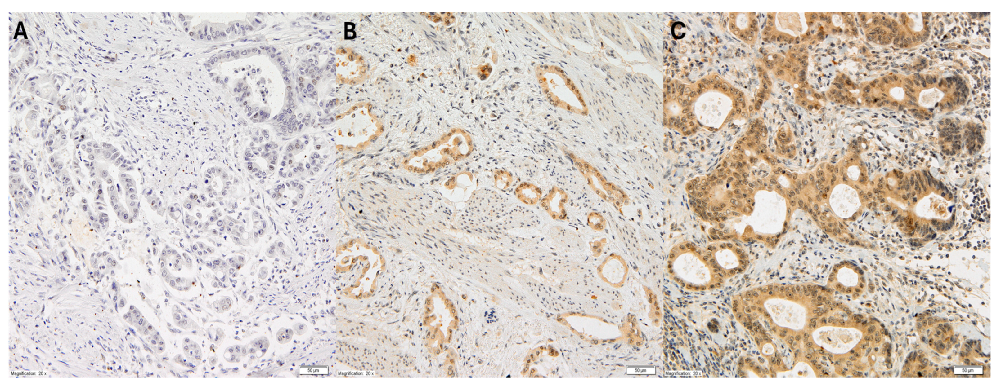 Cancers 17 01406 g001