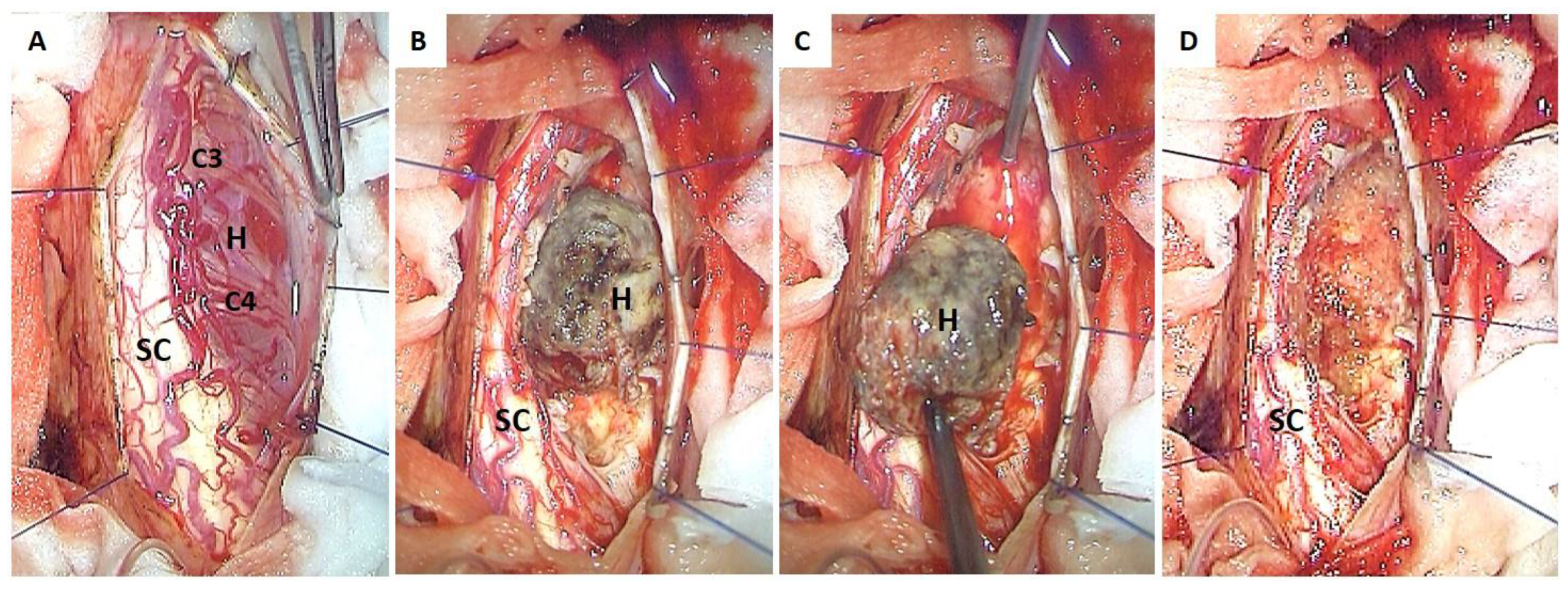 Cancers 17 01428 g002
