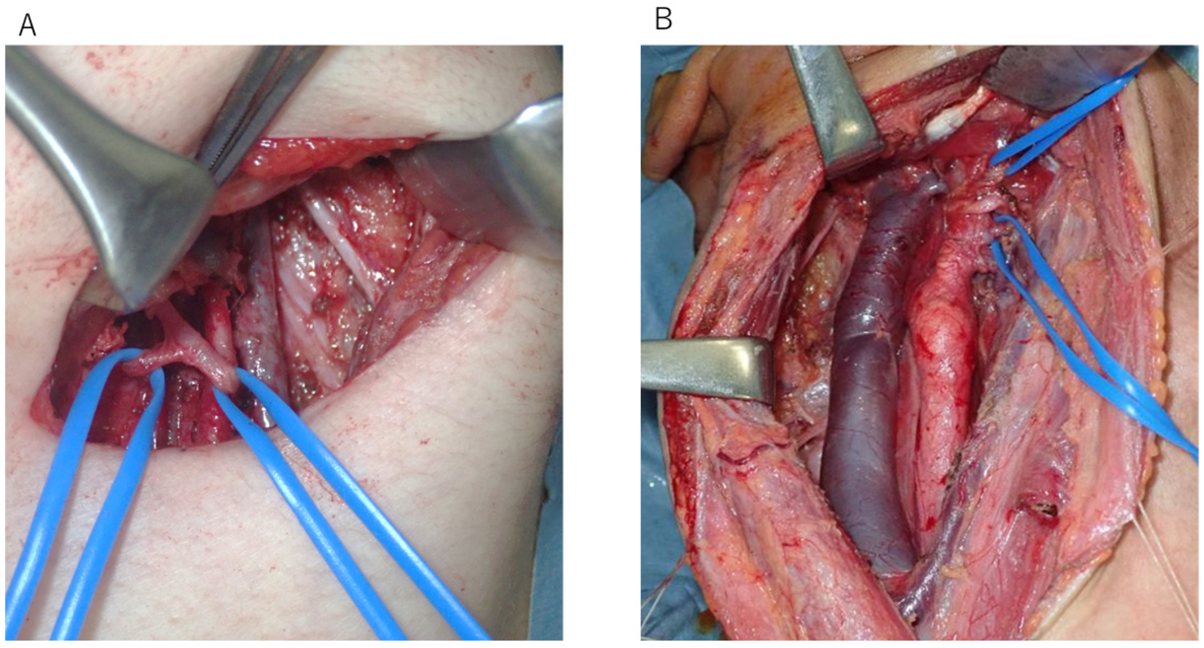 Cancers 17 01446 g001