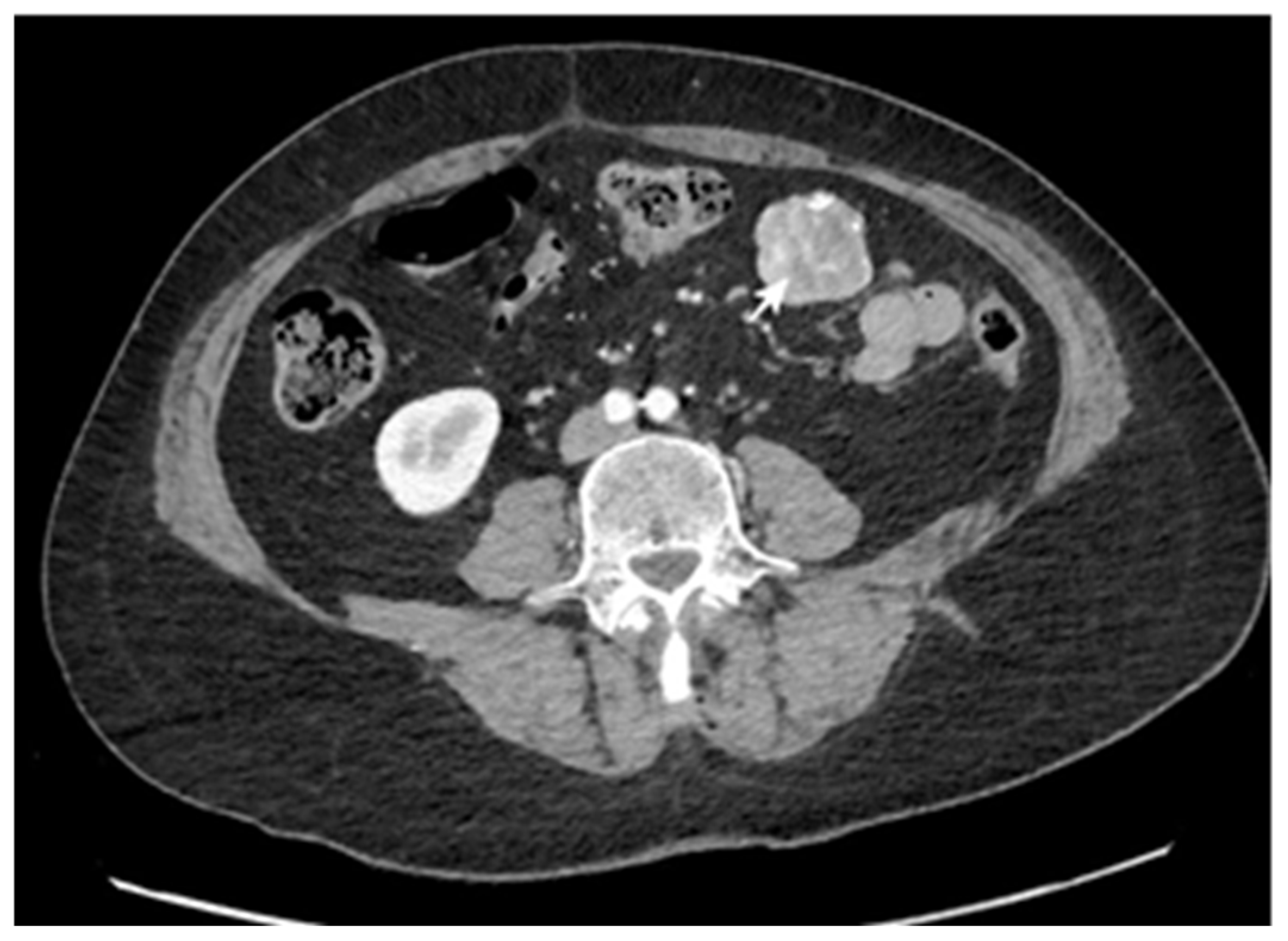 Cancers 17 01465 g002