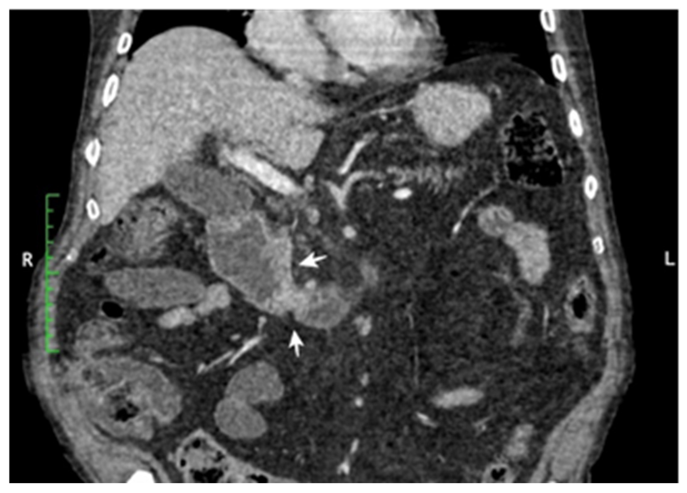 Cancers 17 01465 g003