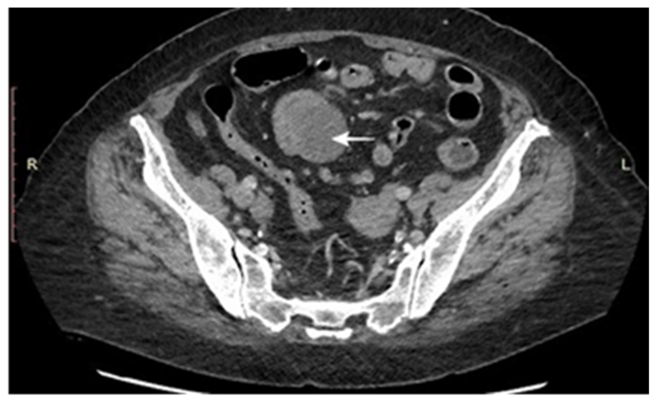 Cancers 17 01465 g004