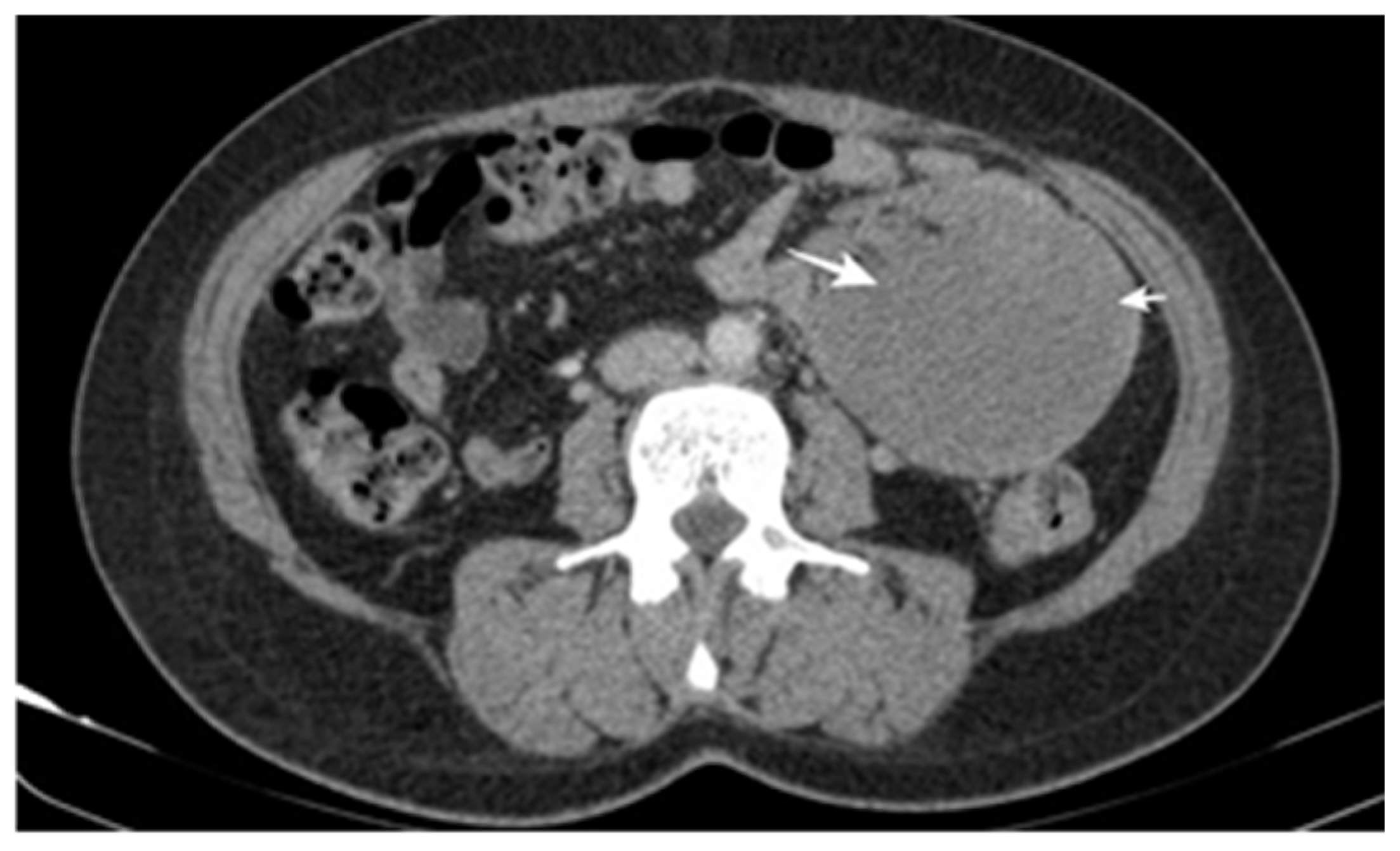 Cancers 17 01465 g005