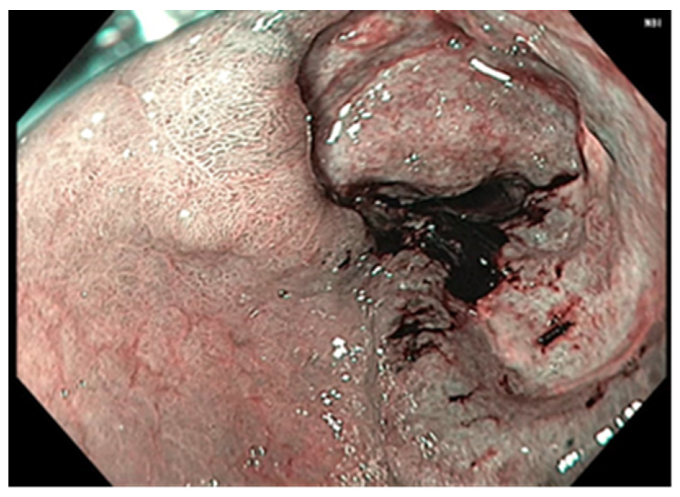 Cancers 17 01465 g006