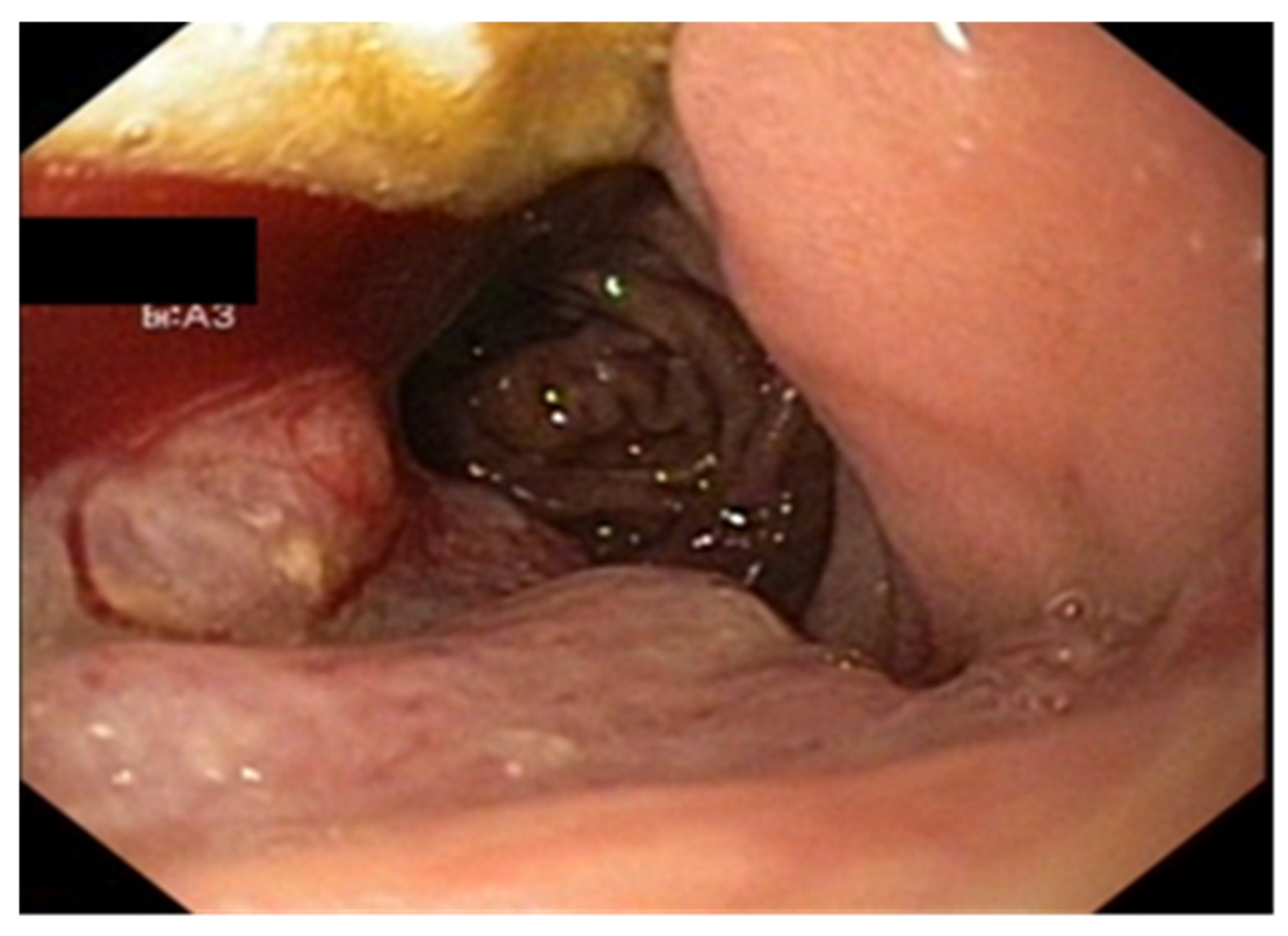 Cancers 17 01465 g007