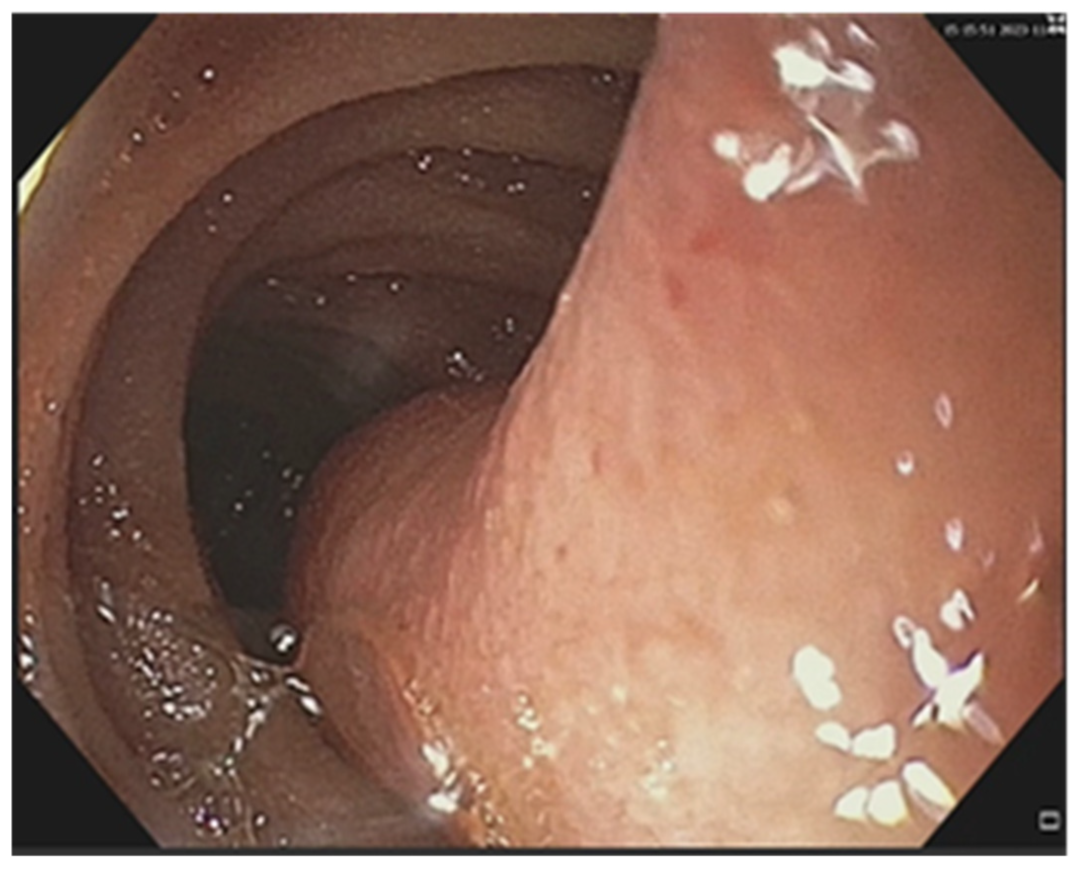 Cancers 17 01465 g008