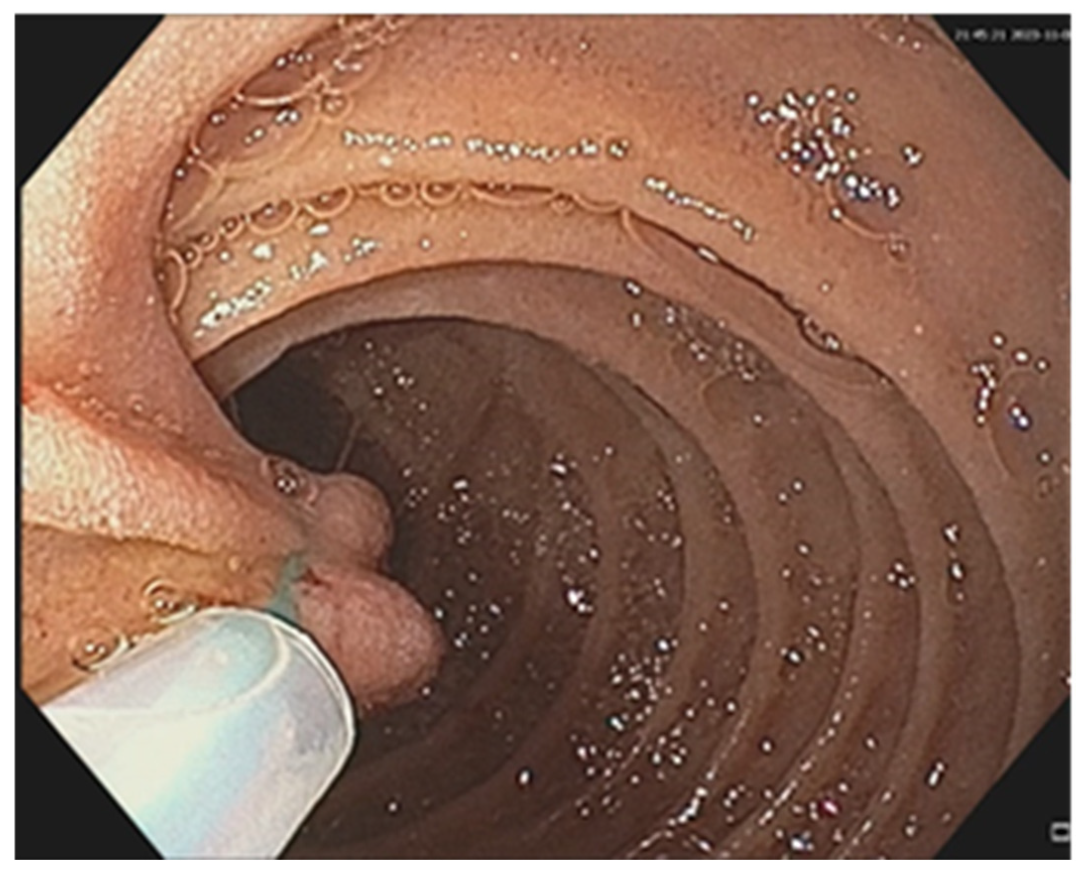 Cancers 17 01465 g009