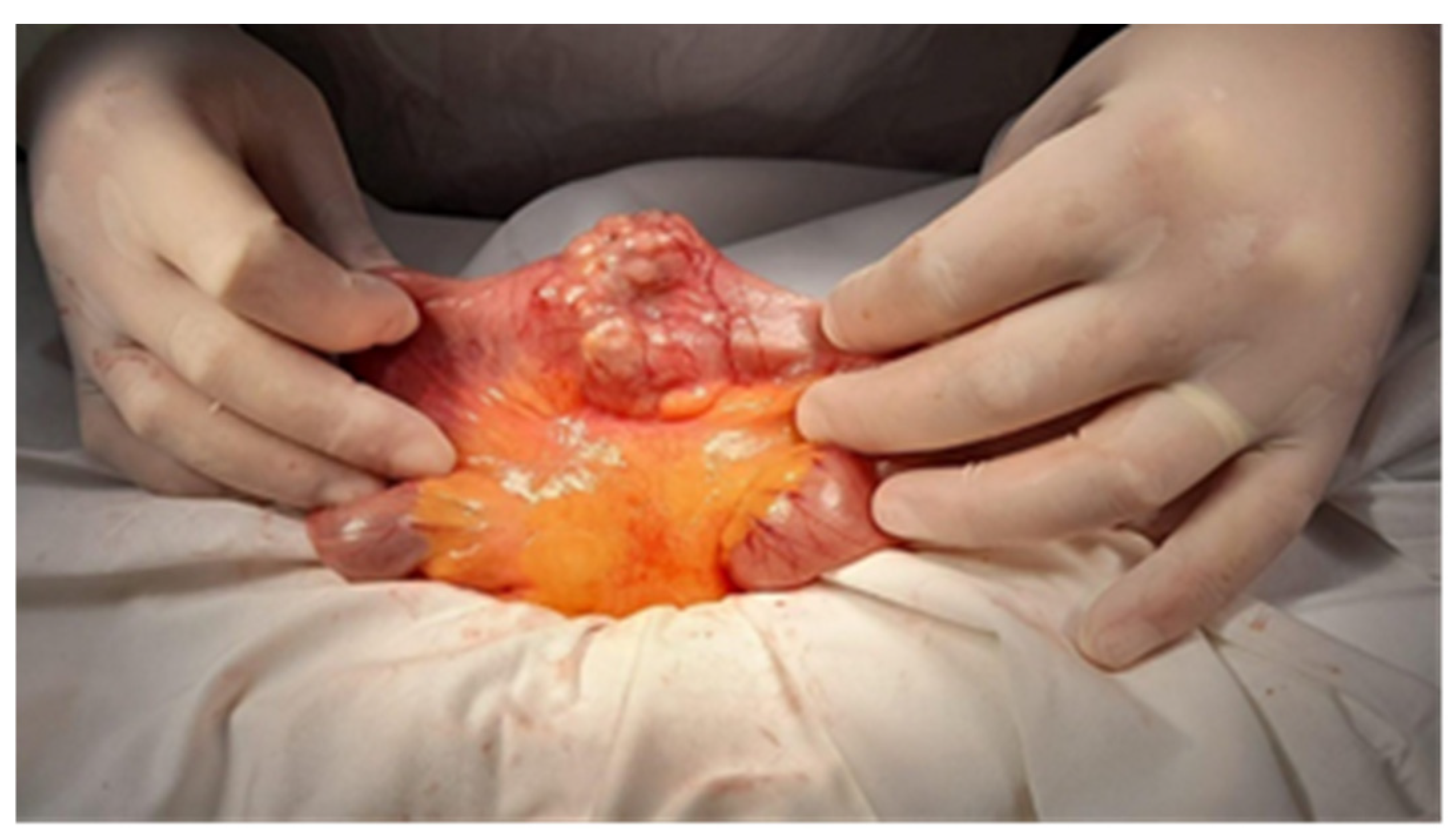 Cancers 17 01465 g010