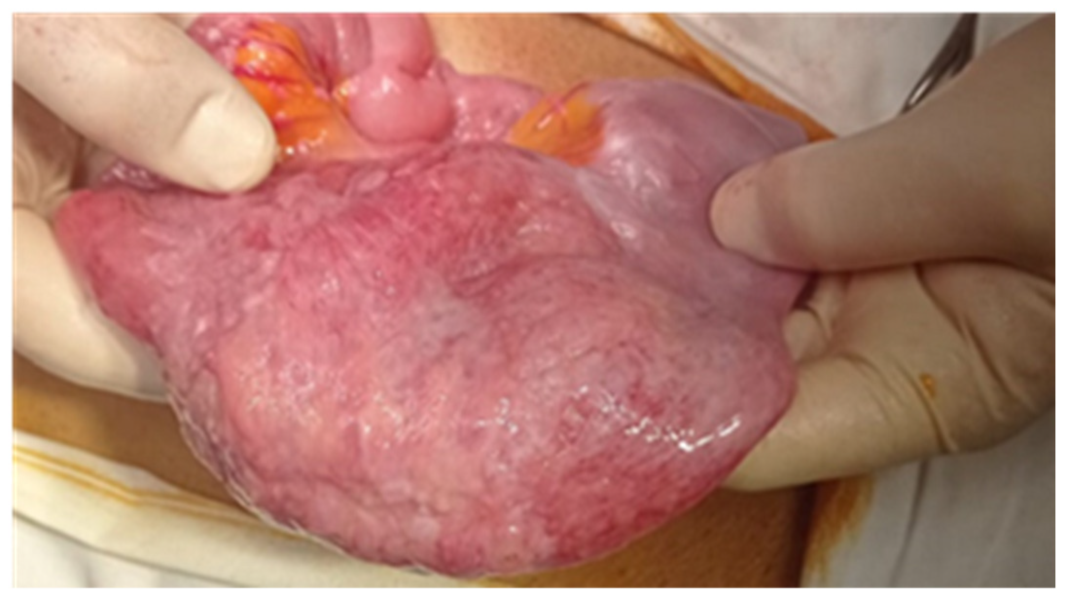 Cancers 17 01465 g011