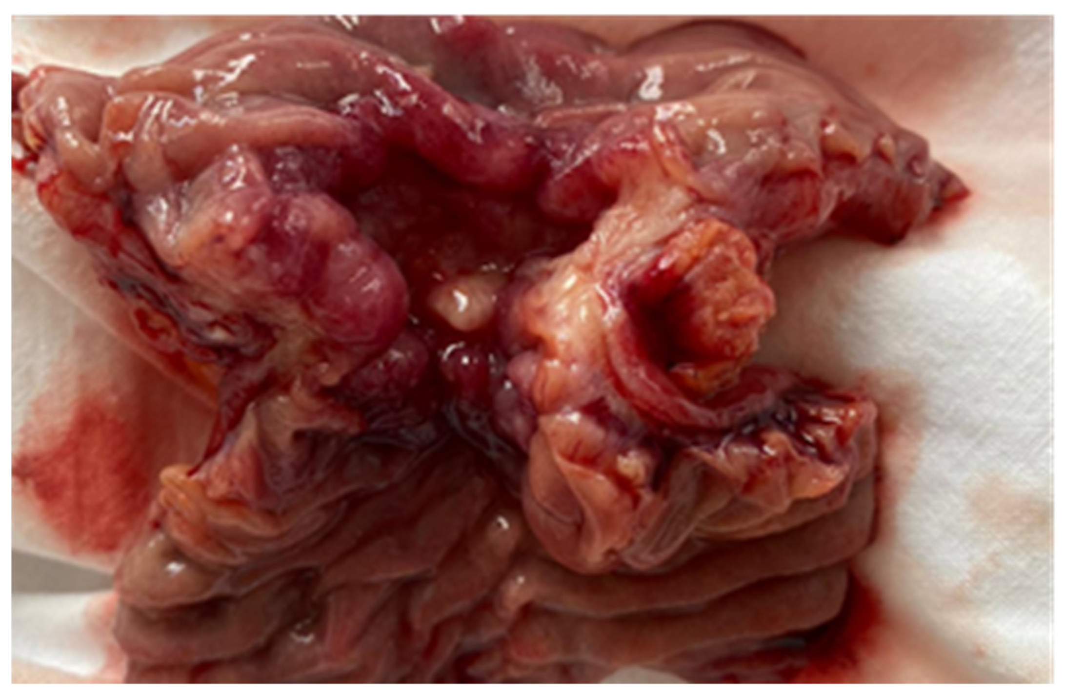 Cancers 17 01465 g012