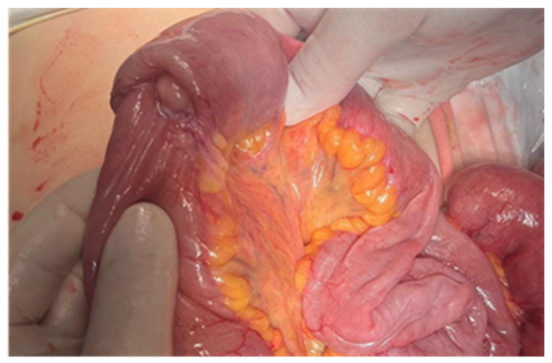 Cancers 17 01465 g013