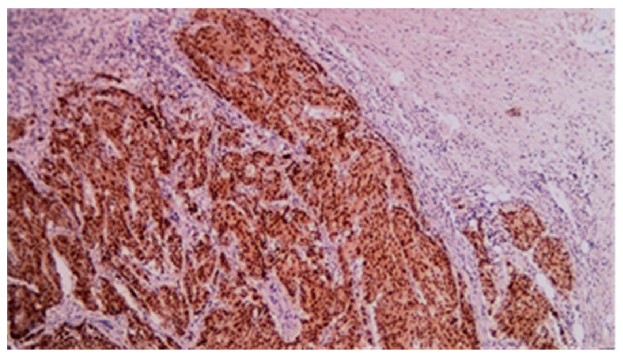 Cancers 17 01465 g014