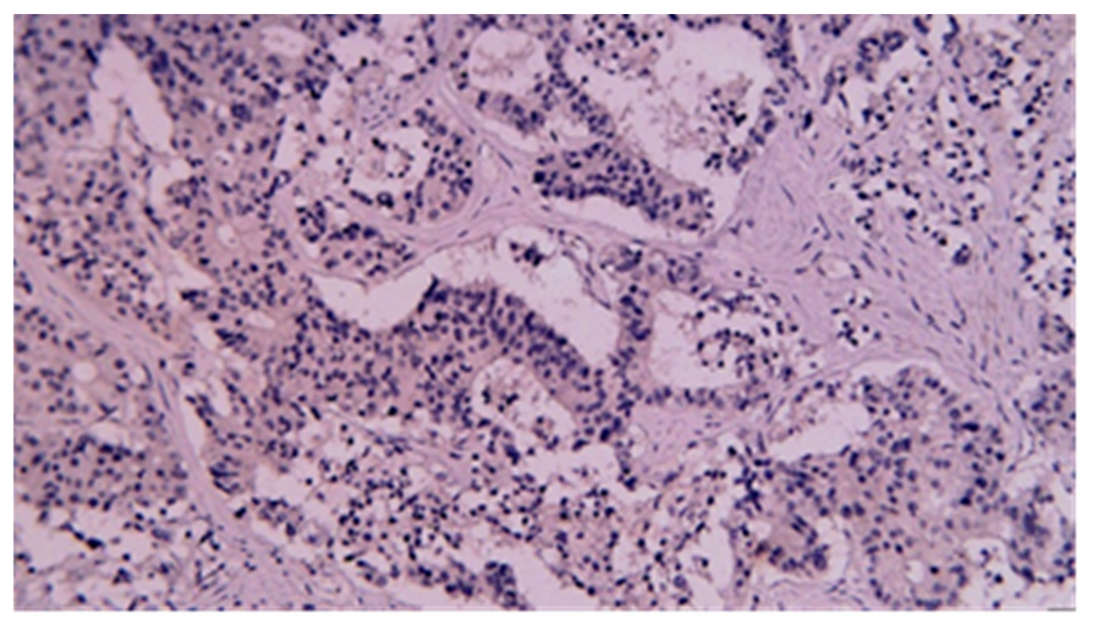 Cancers 17 01465 g015