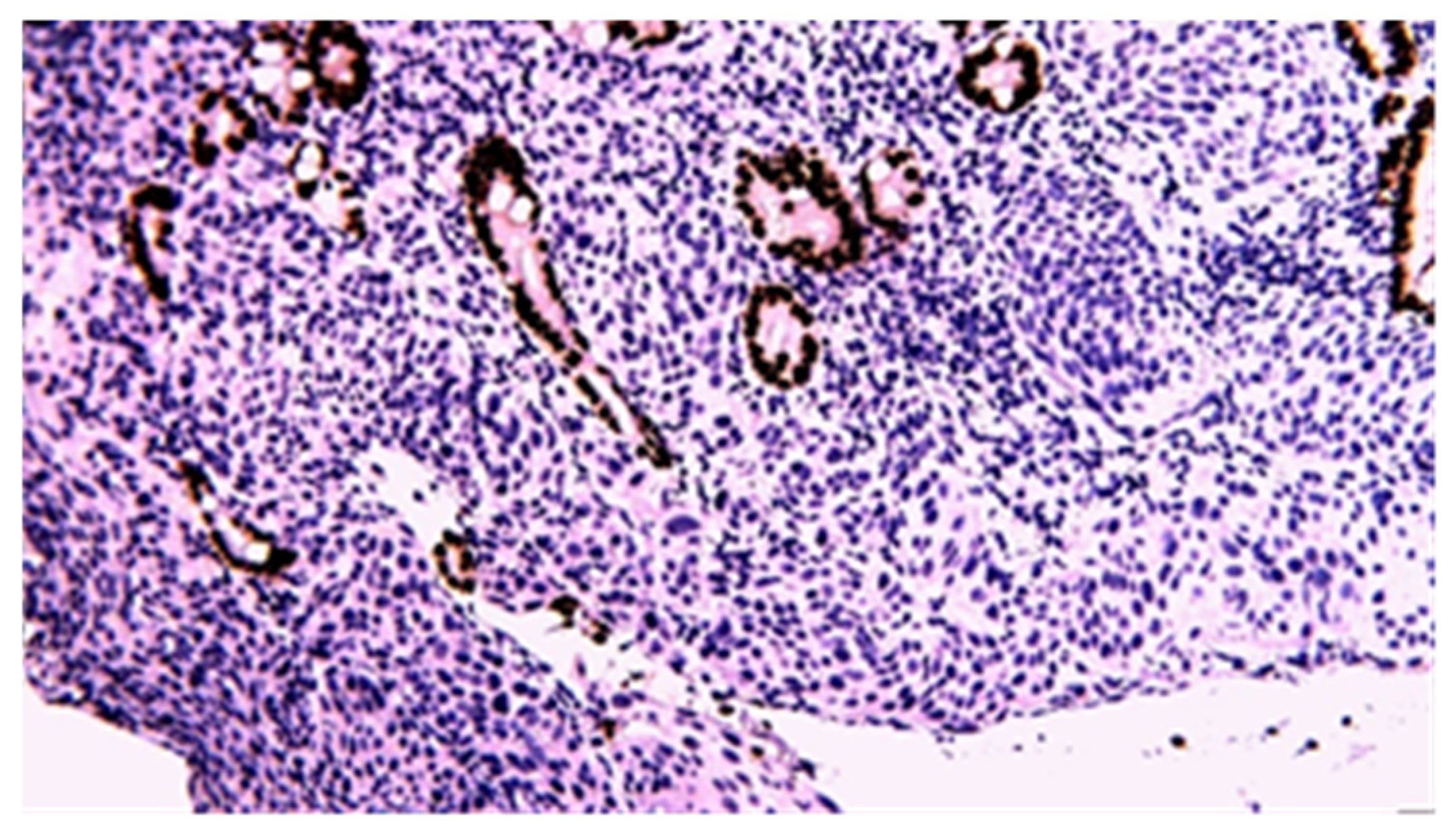 Cancers 17 01465 g016