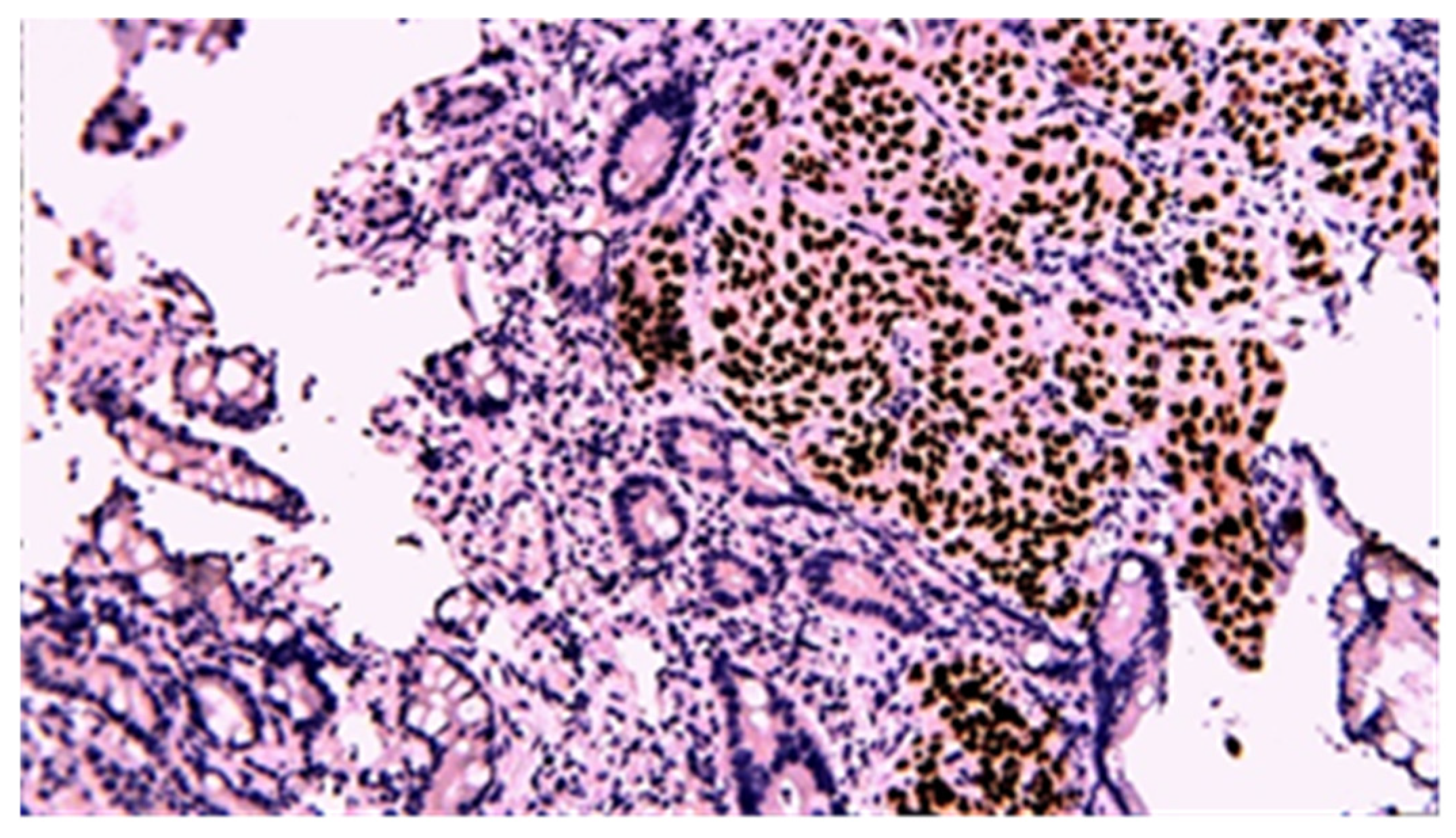 Cancers 17 01465 g017