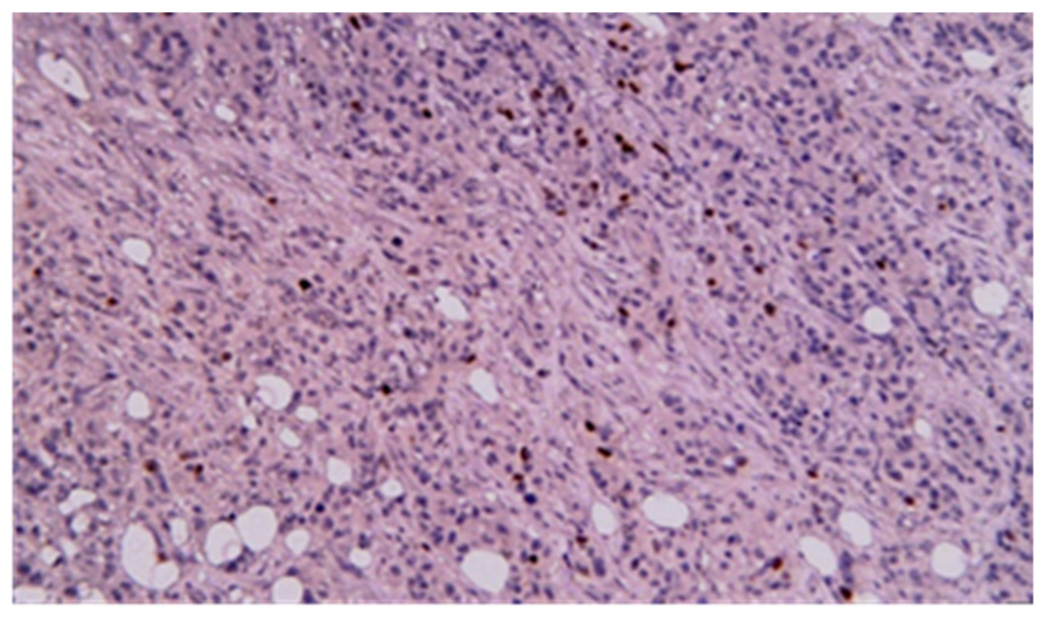 Cancers 17 01465 g018