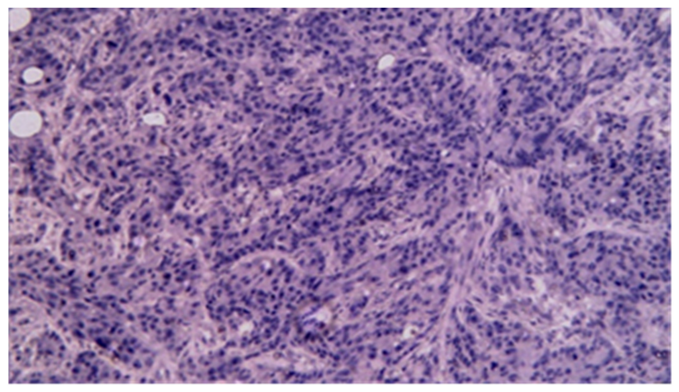 Cancers 17 01465 g019