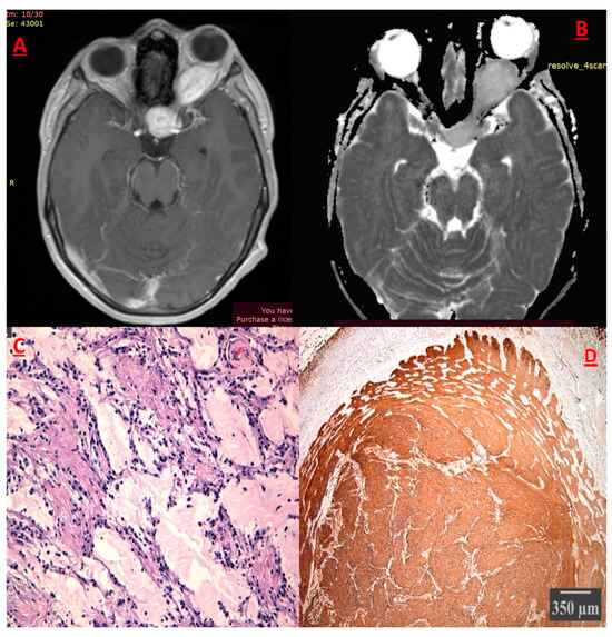 Cancers 17 01566 g005