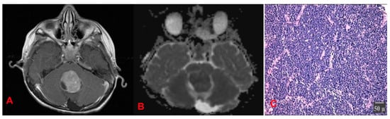 Cancers 17 01566 g017