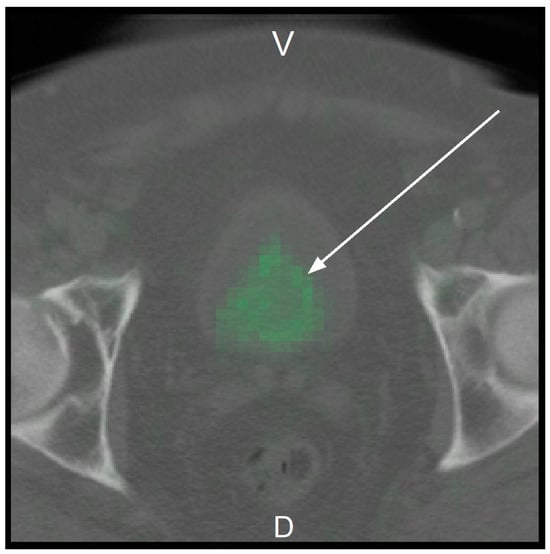 Cancers 17 01575 g0a1