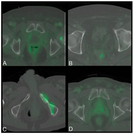 Cancers 17 01575 g0a2